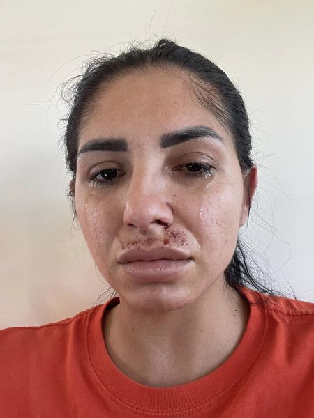 Мајка (25) претепана од двајца мажи пред трговски центар поради ред на ...